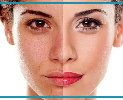 تغییرات پوستی در دوران بارداری