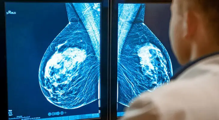 فوق تخصص پستان