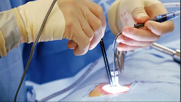 جراحی بواسیر یا هموروئید