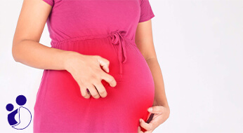 کلستاز بارداری