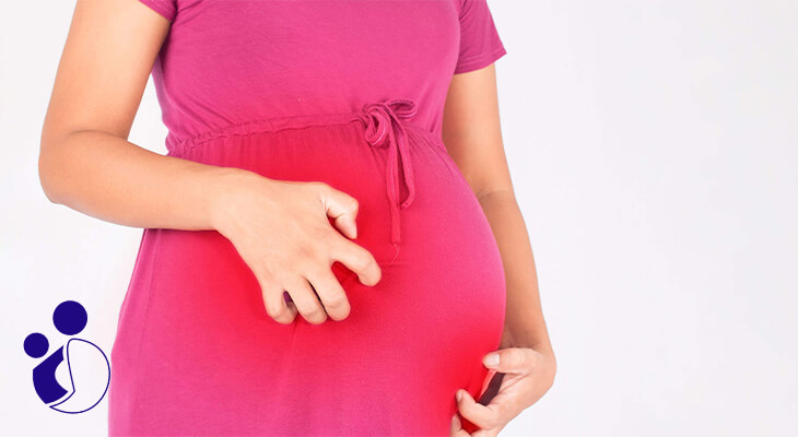 علت کلستاز بارداری