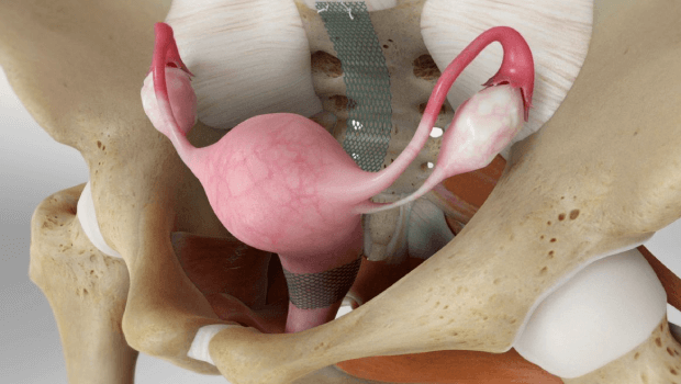 علائم افتادگی رحم