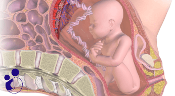 جدا شدن جفت از جنین