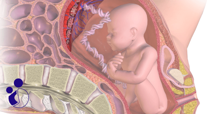 دلایل شایع جدا شدن جفت از جنین