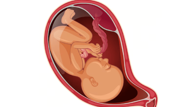 تشخیص جدا شدن جفت از جنین