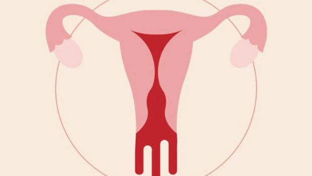 خشکی واژن و خونریزی بعد از رابطه