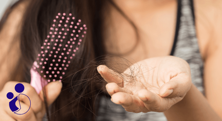 تنبلی تخمدان و ریزش مو