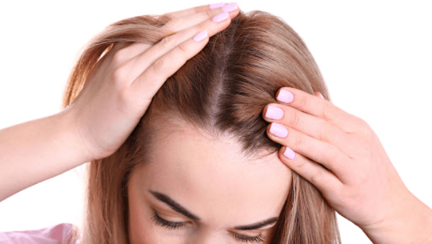 علت ریزش شدید و ناگهانی مو در زنان