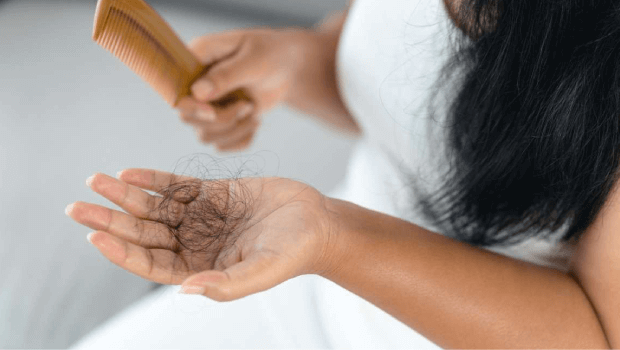 درمان ریزش مو در زنان