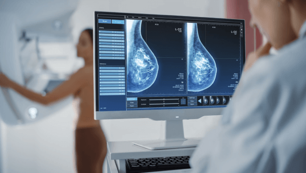 سونوگرافی بهتر است یا ماموگرافی