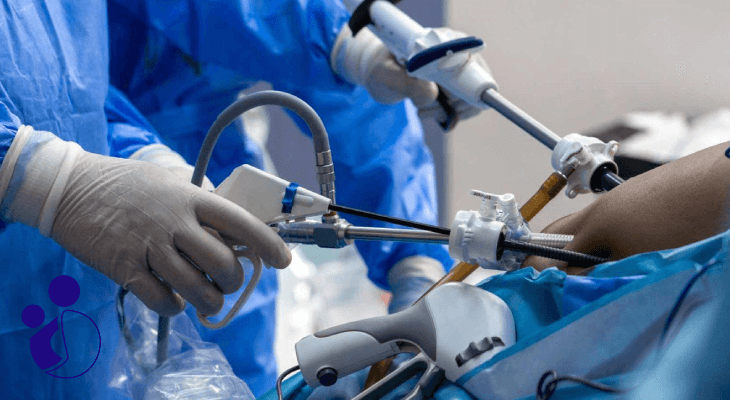 معرفی بهترین اسلیو معده در کرج