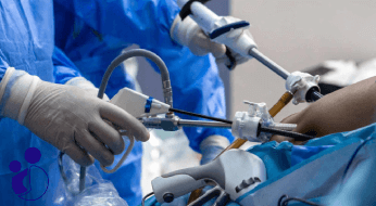 بهترین اسلیو معده در کرج