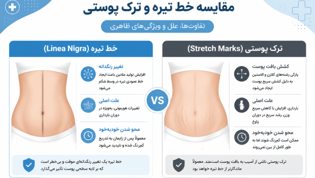 تفاوت بین خط تیره شکم و ترک پوستی در بارداری